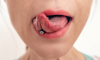 Jak piercing v jazyku ovlivňuje zdraví Vašich zubů